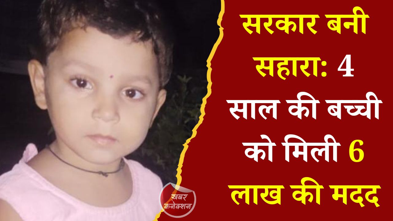 CG News: मुख्यमंत्री विशेष स्वास्थ्य सहायता योजना से बदली मासूम आँचल की जिंदगी, AIIMS रायपुर में मिलेगा निःशुल्क इलाज