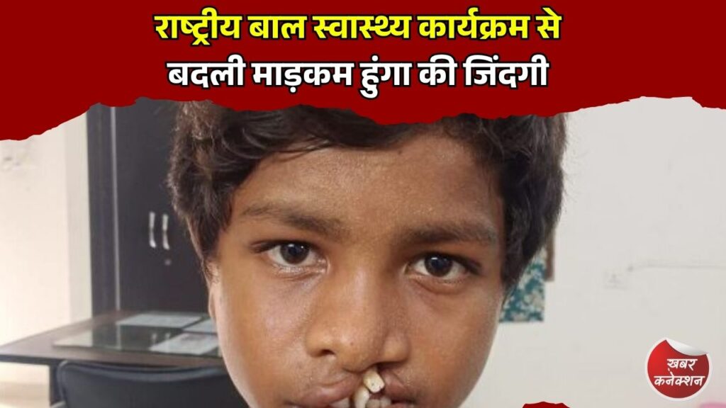 CG News: राष्ट्रीय बाल स्वास्थ्य कार्यक्रम से बदली माड़कम हुंगा की जिंदगी, जन्मजात बीमारी से मिली मुक्ति